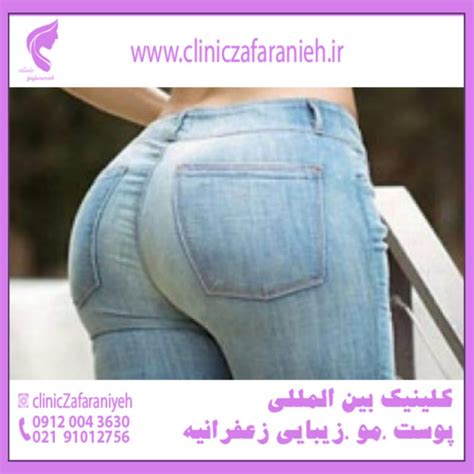 چگونه باسن برزیلی داشته باشیم؟ کلینیک بین المللی پوست و مو زیبایی زعفرانیه