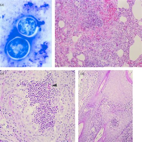 Pdf Mucormycosis In The Platypus And Amphibians Caused By Mucor