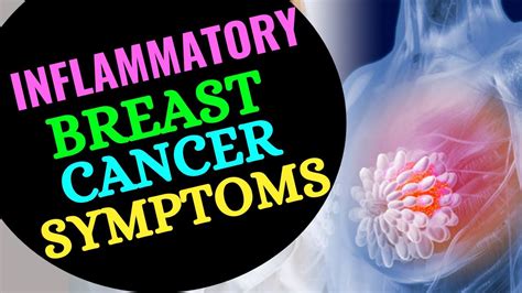 what are early signs of inflammatory breast cancer top 10 inflammatory breast cancer ibc