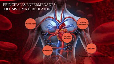 Principales Enfermedades Sistema Circulatorio By Laury Vanessa Marin