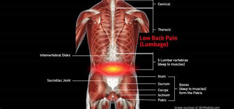 Muscles of the back can be divided into superficial, intermediate, and deep group. Management of Low Back Pain - Beacon Pharmaceuticals Limited