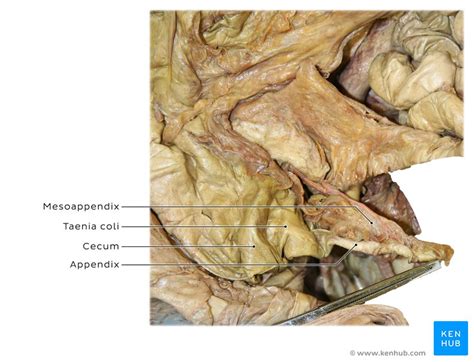 The word appendix or appendices (yes, you can have more than one) usually scares students of all ages. Subhepatic appendicitis: Symptoms, diagnosis, treatment | Kenhub