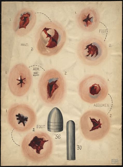 Bullet Wound Drawing Reference Deriding Polyphemus