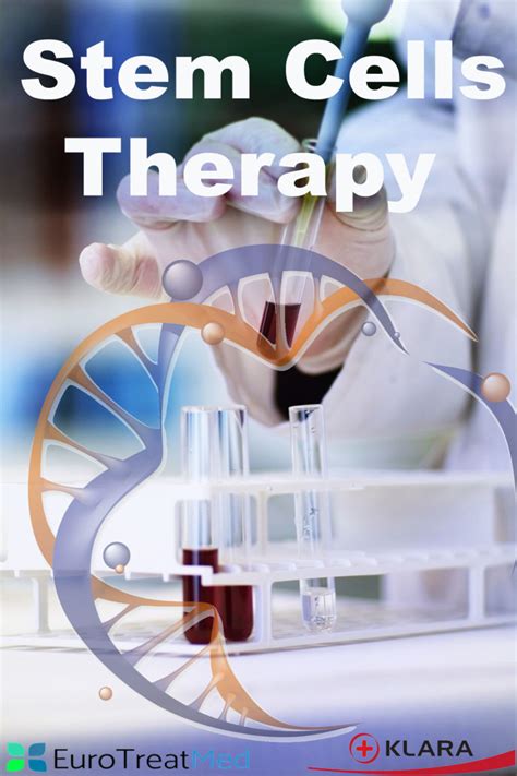mesenchymal stem cells therapy advanced treatment in poland eurotreatmed
