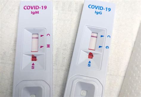 El Instituto Coordenadas pide que las farmacias hagan los test de Covid-19