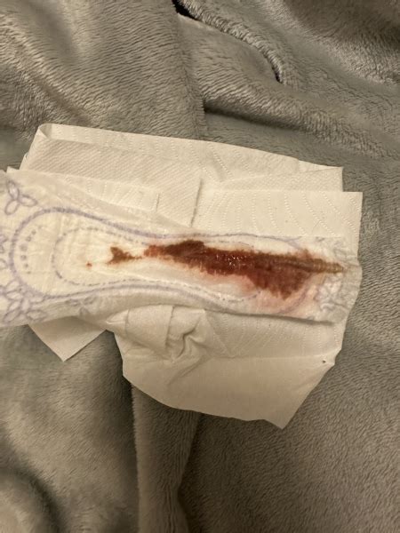 5 Weeks Pregnant Brown Dishchargebleeding With Cramps Mumsnet