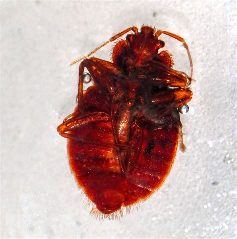Pathology Outlines Cimex Lectularius Bed Bug
