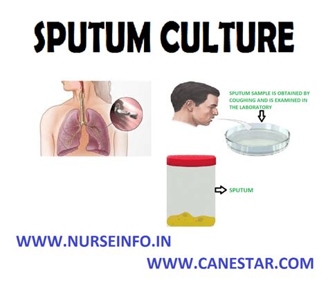 Sputum Culture Purposes General Instructions Client Preparation