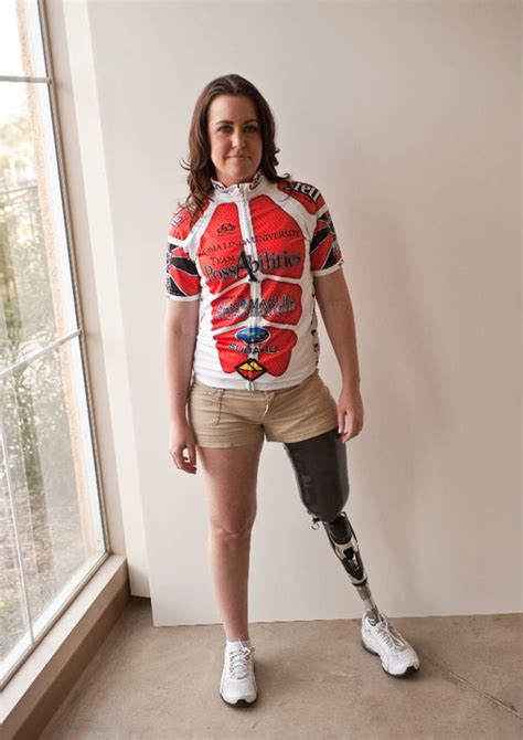 amputee woman prosthetic leg