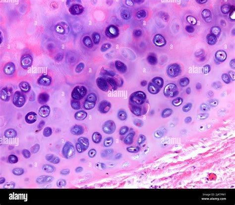 Isogenous Groups In Hyaline Cartilage Light Micrograph Stock Photo Alamy