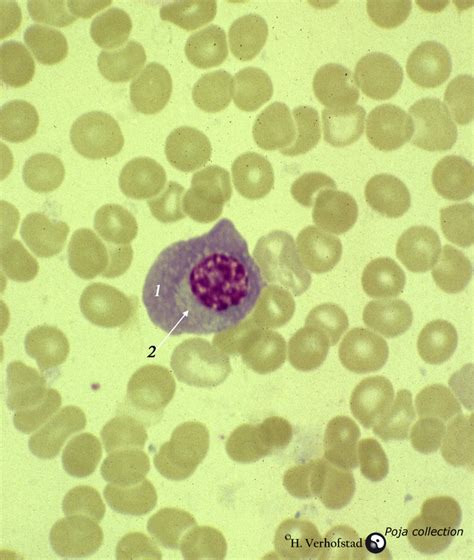 Normal Plasma Cell In Peripheral Blood Smear Human