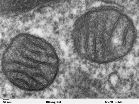 Plant cells tend to have more uniform sizes than. Mitochondrion - Wikipedia