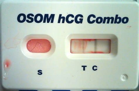 Blood Serum Pregnancy Test