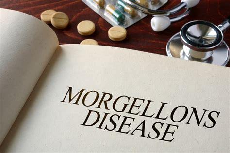 Frequently Asked Questions About Morgellons Disease Facty Health