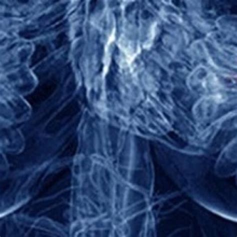 Mamografie Digitală Cu Tomosinteză Imagistica Sanador