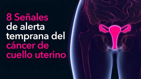 Sintomas de embarazo en el hombre primer mes autismo sintomas causas. 8 Señales de alerta temprana del cáncer de cuello uterino ...