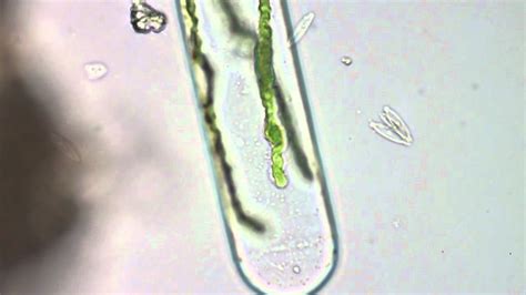 Spirogyra Filamentous Green Algae Youtube
