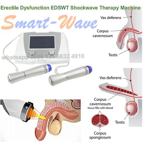 Gainswave Ed 1000 Shockwave Ed Erectile Dysfunction Treatments