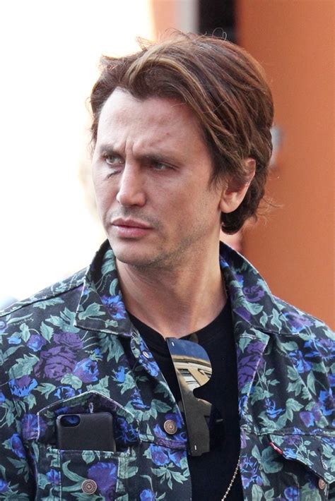 Ouch Jonathan Cheban Caught With Nasty Bruise Under His Eye Radar Online