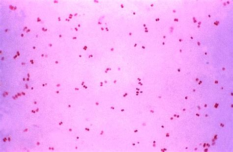 proteobacteria bacterias reino monera infoescola