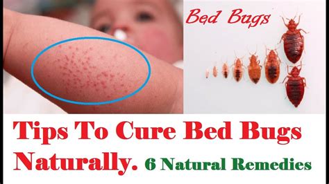Tips To Cure Bed Bugs Naturally ¦ 6 Natural Remedies Youtube