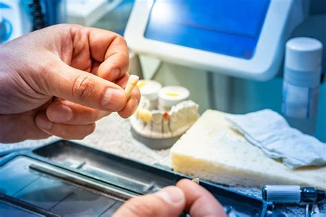 Many factors influence how much patients pay for dental veneers, which can be made from porcelain as well as resin composite materials. Veneers Cost