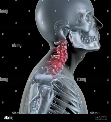 3d Render Of A Skeleton With Neck Bones Highlighted Stock Photo Alamy