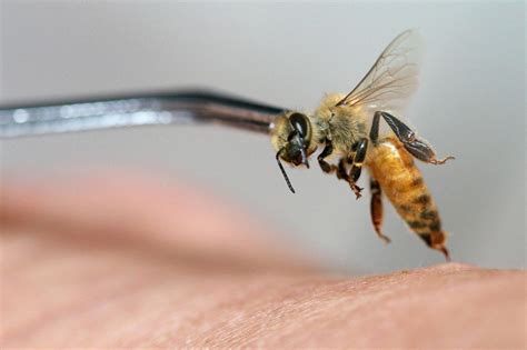 3 Interesting Types Of Bee Venom Therapy Science Times