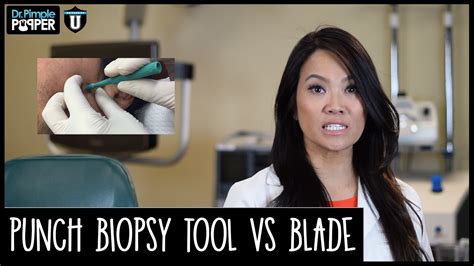 Removing Cysts Choosing Between Punch Tool And Surgical Blade Youtube