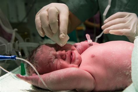 Mengenal Tes Apgar Yang Dilakukan Pada Bayi Baru Lahir