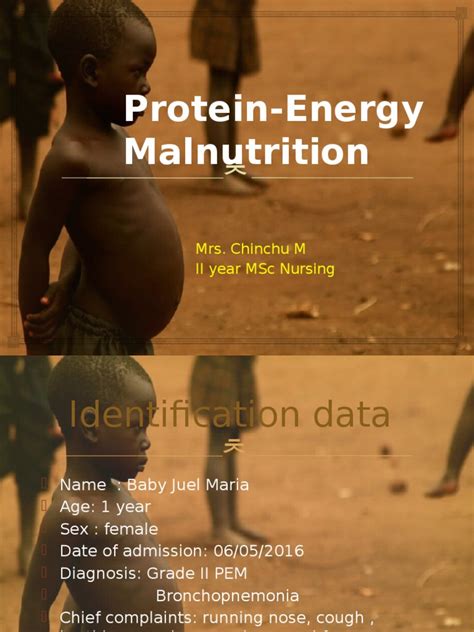 Pem Ppt Malnutrition Nutrition