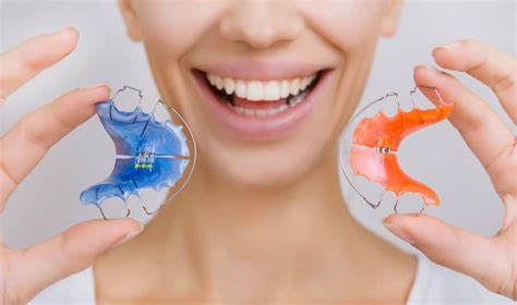 Why Retainers Are Important After Braces Wilkinson Orthodontics