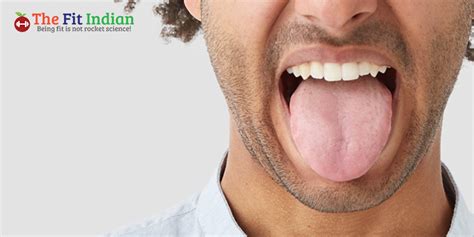 Dangers Of Tongue Discoloration Diseases Associated With Tongue Color