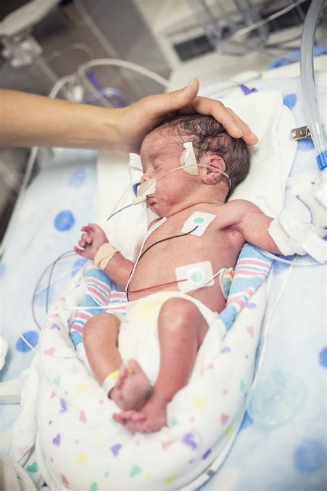 Newborn Premature Baby In The NICU Intensive Care ABD