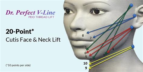 Dr Perfect V Line Thread Lift Singapore Face Lifting Procedure