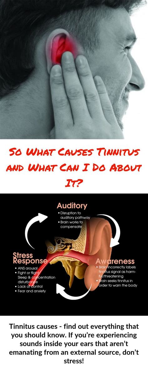 Tinnitus Is Most Notieceable When Youre On Your Own In What Would