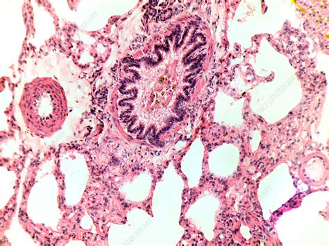 Lung Tissue Of A Cat Lm Stock Image C0093469 Science Photo Library