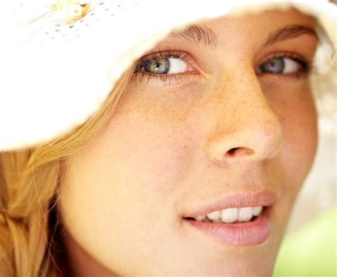 Freckles Vs Moles A Dermatologist Explains Freckles Skin Care