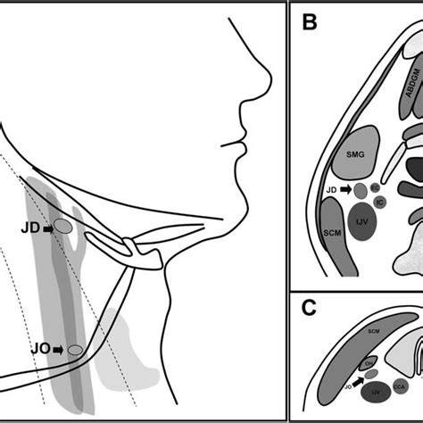 Illustrations Show The Anatomical Location Of Jugulodigastric Jd And