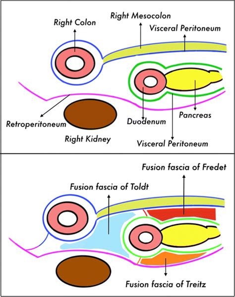 Drawing Showing The Embryological Development Of The Fusion Fascia Of