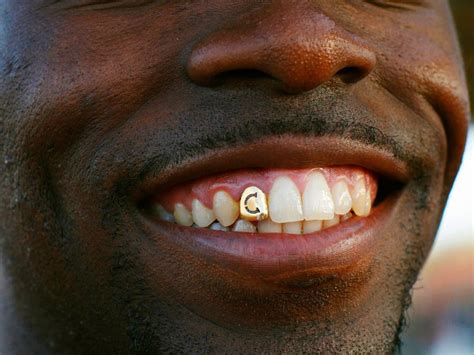 Find the perfect gold denture teeth stock photos and editorial news pictures from getty images. How gold is actually used - Business Insider