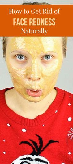 How To Cure Redness On Face 6 Home Remedies And Treatment Redness On