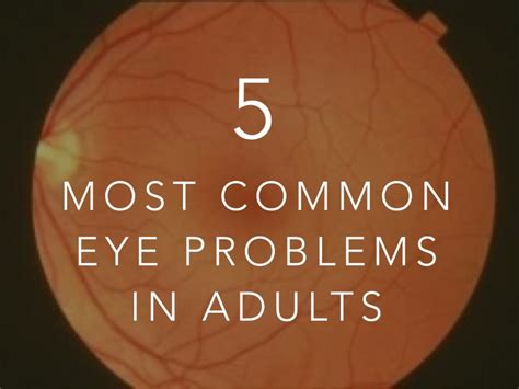 The Five Most Common Eye Problems In Adults Hubpages