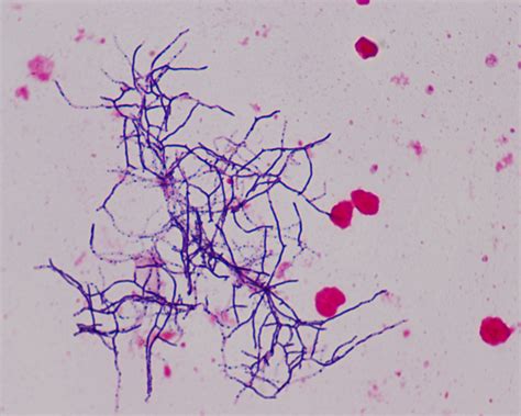 Microbiologia Medica Nocardia