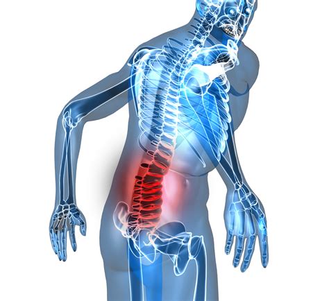 While most back twinges go away on their own after a few days, many. 5 Common Causes of Low Back Pain