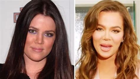 Reason Behind Khloe Kardashian Transformation Does Khloe Had Plastic Surgery