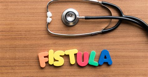 Fistulas And Crohns Disease Ibdrelief