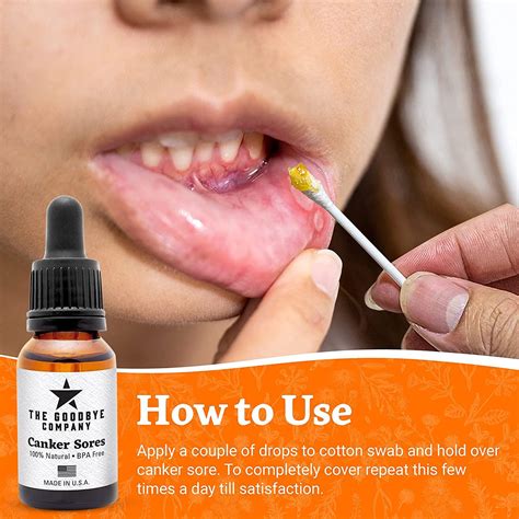 Goodbye Canker Sores Helpful For Mouth Ulcer Treatment Effective Essential Oil Serum For