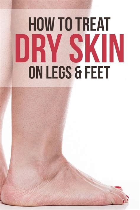 What Causes And How To Treat Dry Skin On Legs Skin Care Tips Treating