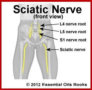 This type of pain that radiates along the course of a particular. Pin on l4 l5